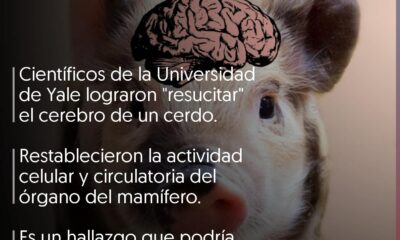 Actividad cerebral